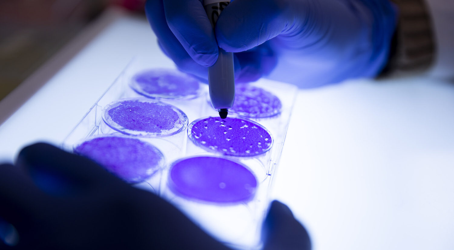 Microbiological Samples in Petri Dish